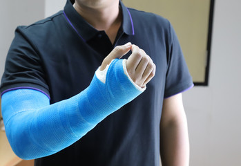 Closeup of Asian man's arm with long arm plaster, fiberglass cast therapy cover by blue elastic bandage after sport injury. 