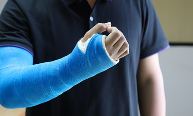 Closeup of Asian man's arm with long arm plaster, fiberglass cast therapy cover by blue elastic...
