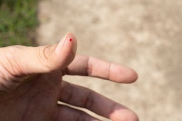 A person with a drop of blood on their thumb from a cat attack