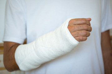 Plaster cast arm, adult man, white dressed