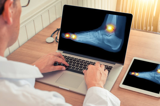Doctor watching a laptop and digital tablet with x-ray of a foot with pain relief in the ankle and toes in a medical office