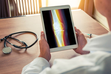 Doctor holding a digital tablet with x-ray of knee. Pain on the leg. Stethoscope and syringe on the desk
