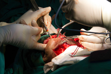 Doctors performing a surgery 