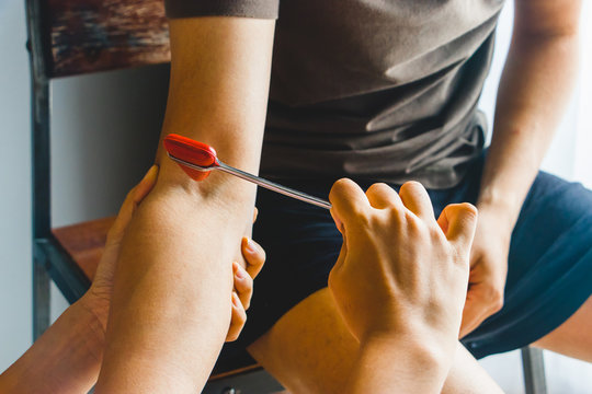 Doctor testing biceps tendon reflex with red hummer jerk on young man arm.