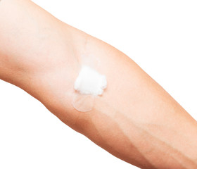 stab from the injection on the hand with cotton