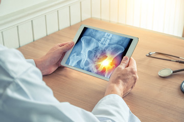 Doctor holding a digital tablet with x-ray of hips. Pain in the right