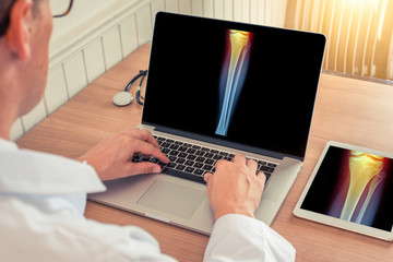 Doctor watching a laptop and digital tablet with x-ray of leg with pain relief on the knee in a medical office