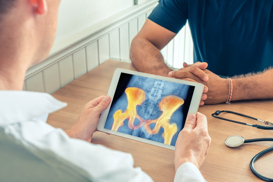 Doctor holding a digital tablet with x-ray of hips of the patient. Pain in the bone
