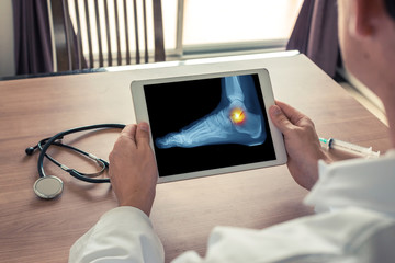 Doctor holding a digital tablet with x-ray of the foot and pain on the ankle