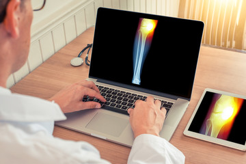 Doctor watching a laptop with x-ray of leg with pain relief on the internal knee in a medical office