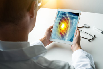 Doctor holding a digital tablet with x-ray of chest with pain. Heart attack concept