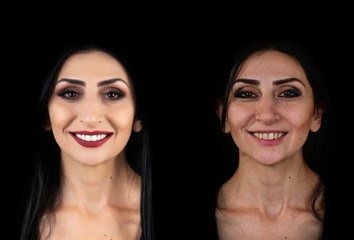 portrait of young lady  before and after , after with 10 unit ceramic veneers