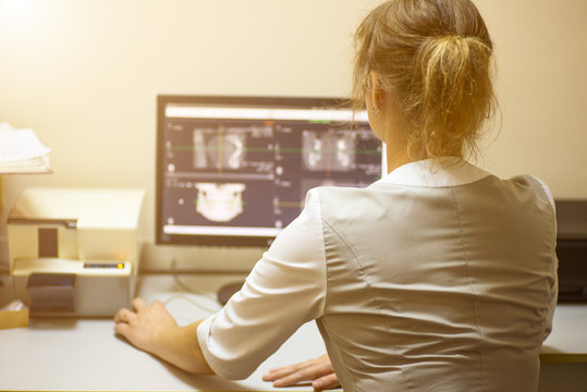 a doctor woman looks at the monitor volumetric picture of the jaw and teeth in a dental clinic