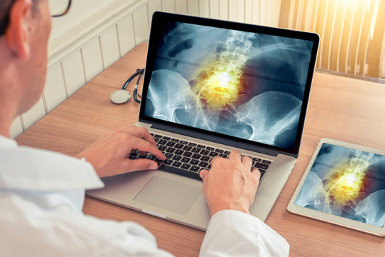 Doctor watching a laptop with x-ray of hips with pain relief on spine in a medical office