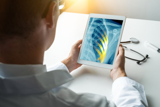 Doctor holding a digital tablet with x-ray of chest with pain on the ribs
