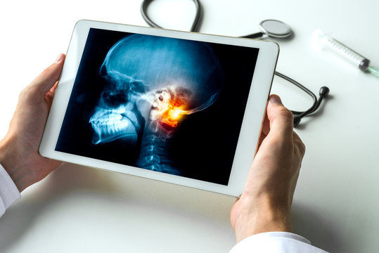 Doctor watching a x-ray of pain on a neck of a skull on digital tablet. Meningitis migraine headache and radiology concept