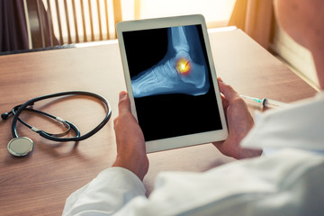 Doctor holding a digital tablet with x-ray with pain on the ankle of the foot. Stethoscope and...