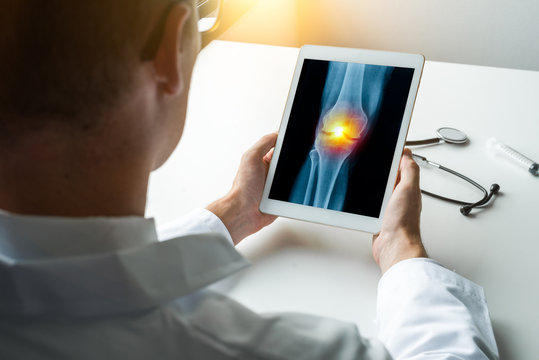 Doctor holding a digital tablet with x-ray of pain on the knee. Front view