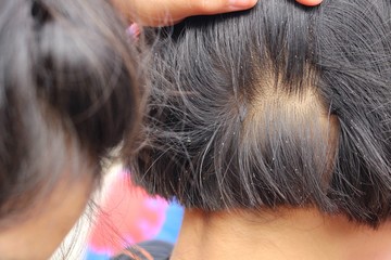 Obraz premium Girls lice on the head, filmed as blurred images