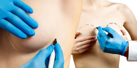 Collage. Plastic surgery for female breast correction.
