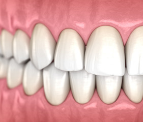 Mandibular human gum and teeth anatomy. Medically accurate tooth 3D illustration