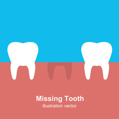 A Single Missing Tooth  Illustration Vector