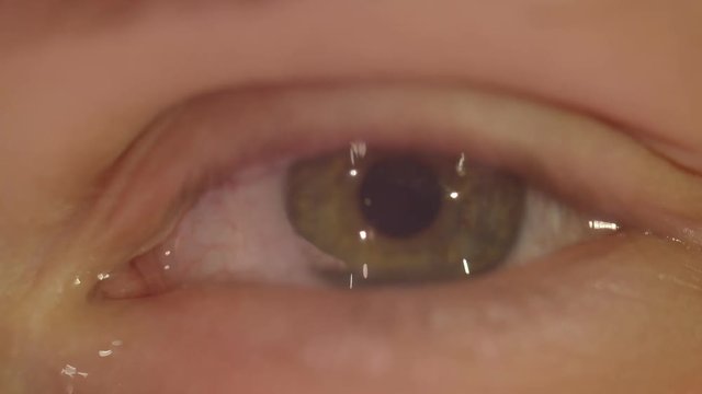 Close-up shoot of peson with green eye blinks fastly with tears falling being depressed and sad watching into camera.