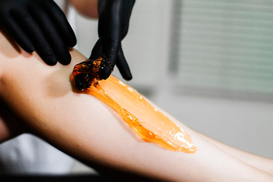 Beautician removes hair on the patient's legs with the help of shugaring