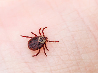 Encephalitis Virus or Lyme Borreliosis Disease Infectious Dermacentor Tick Arachnid Parasite Insect on Skin Macro