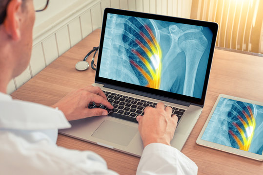 Doctor watching a laptop with x-ray of a chest with pain relief in the ribs in a medical office