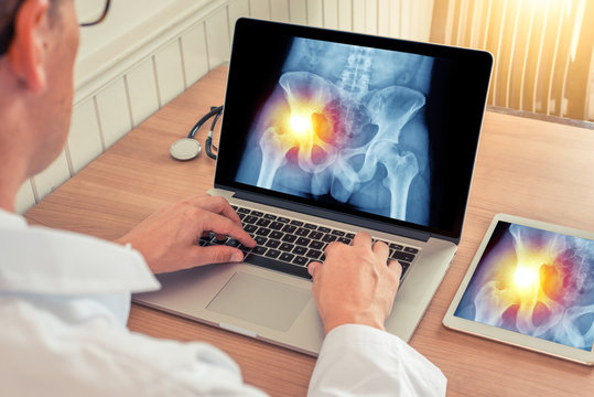 Doctor watching a laptop and digital tablet with x-ray of hips with pain relief on the left in a medical office