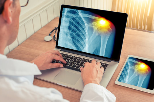 Doctor watching a laptop and digital tablet with x-ray of chest with pain relief in the shoulder in a medical office