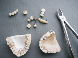 Dental prosthesis equipment and tools. Two gypsum jaws dentures crowns and bone forceps on gray background.