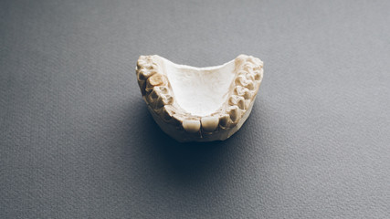 Human jaw layout with ceramic and metal dentures. Dental prosthesis template