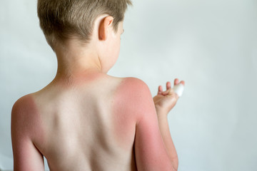 Mother rubs child with protection lotion close up, skincare