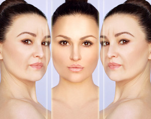 Aging. Mature woman-young woman.Face with skin problem.Showing photos before and after