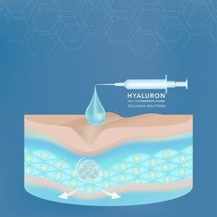 Hyaluronic acid skin solutions ad, blue collagen serum drop with cosmetic advertising background ready to use, syringe in 3d illustration.	