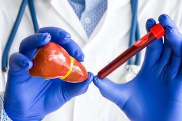 Laboratory medical diagnostics, tests and analysis for liver or hepar concept photo. Doctor or laboratory technician holds in one hand laboratory test tube with blood, in other hand - figure of liver