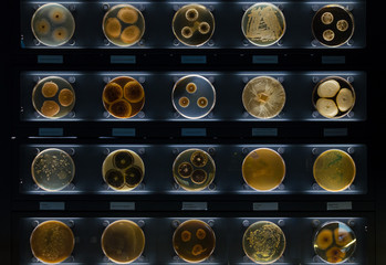 different samples with kinds of bacterias living at common household items- mattress, shoe,...