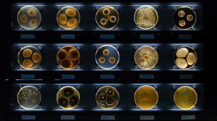 different samples with kinds of bacterias living at common household items- mattress, shoe,...