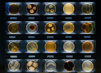 different samples with kinds of bacterias living at common household items- tothbrush, beard, nail...