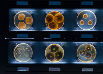 different samples with kinds of bacterias living at common household items- mattress, shoe, moisturizer. © I_love_life