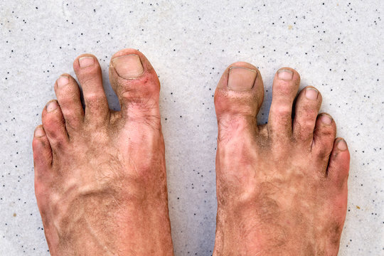 A pair of dirty sore male feet after a dusty and hot summer hike in outdoor sandals