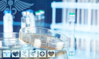 Petri dish with bacterial colonies on base, close-up view