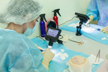 The doctor under the microscope recalculates the hair follicles. Baldness treatment. Hair...