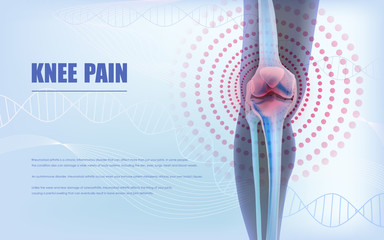 Knee pain relief, bones the of knee