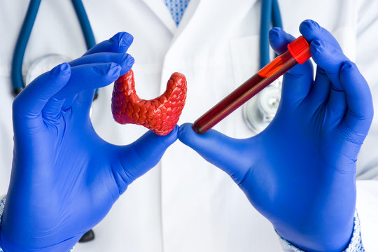 Laboratory medical diagnostics, tests and hormones for thyroid gland concept photo. Doctor or laboratory technician holds in one hand laboratory test tube with blood, in other hand - figure of thyroid