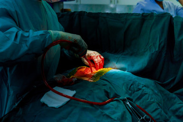 Hospital surgical for cardiovascular emergency surgery center.