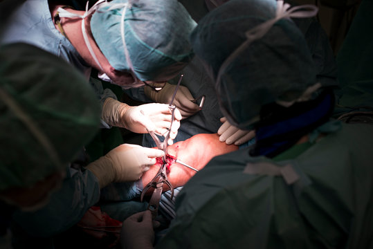 Knee Surgery
