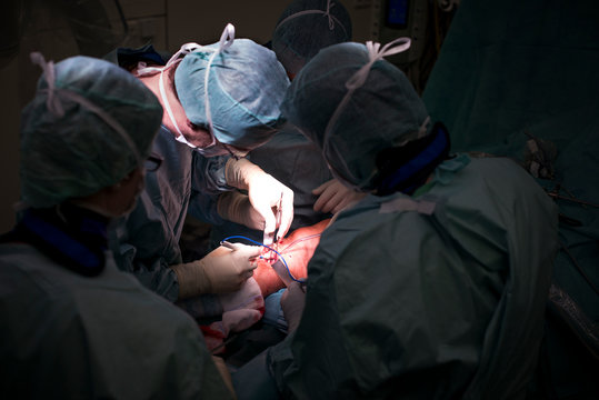 Knee Surgery